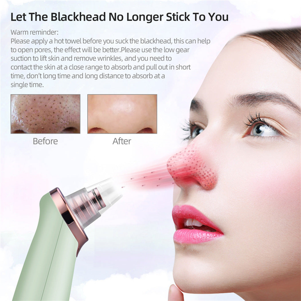 Electric blackhead removal pore cleaner for Acne
